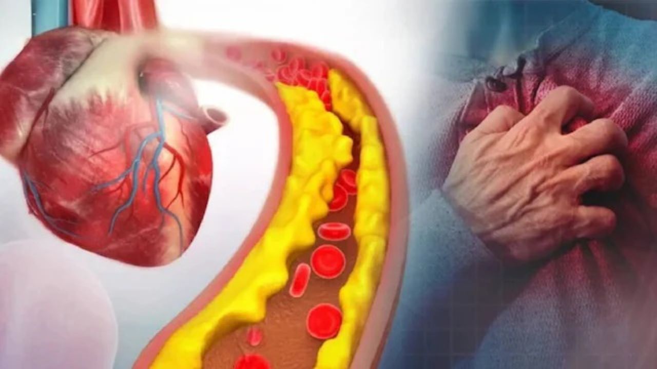 Bad Cholesterol: जीन थेरेपी से कोलेस्ट्रॉल कंट्रोल की नई उम्मीद, दिल की बीमारी में बड़ी क्रांति